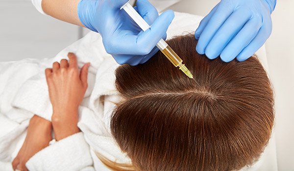 Skilled specialist applying specialized product via syringe during Anti-Hairfall Treatment at Artysto Salon to strengthen hair follicles.